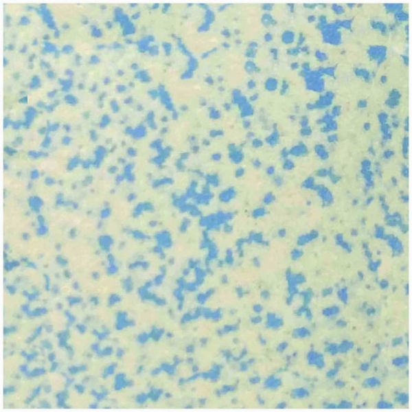 Winckelmans WM Loose 100mm Squares 208 Speckled Blue